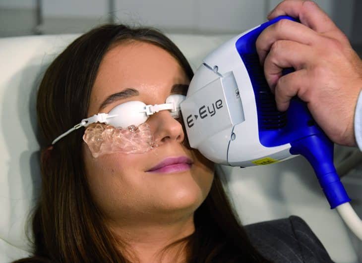 Tratamiento con E-Eye